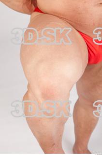 Knee texture of Gene 0001